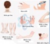 BIẾN CHỨNG DA LIỄU THƯỜNG GẶP Ở BỆNH NHÂN TIỂU ĐƯỜNG