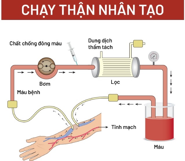 NGHIÊN CỨU NGUY CƠ TIM MẠCH, TIÊN LƯỢNG TỬ VONG THEO THANG ĐIỂM ARO Ở BỆNH NHÂN CHẠY THẬN NHÂN TẠO ĐỊNH KỲ TẠI BỆNH VIỆN ĐA KHOA ĐỒNG NAI